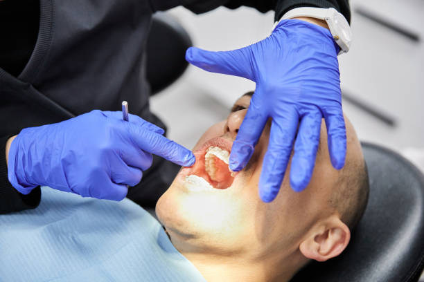 Best Chipped Tooth Repair Near Me  in East Harwich, MA